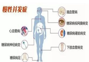 預(yù)防糖尿病并發(fā)癥記住一點穩(wěn)定血糖