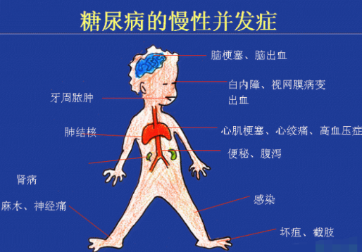 你還在害怕糖尿病嗎？科學補硒不“恐糖”