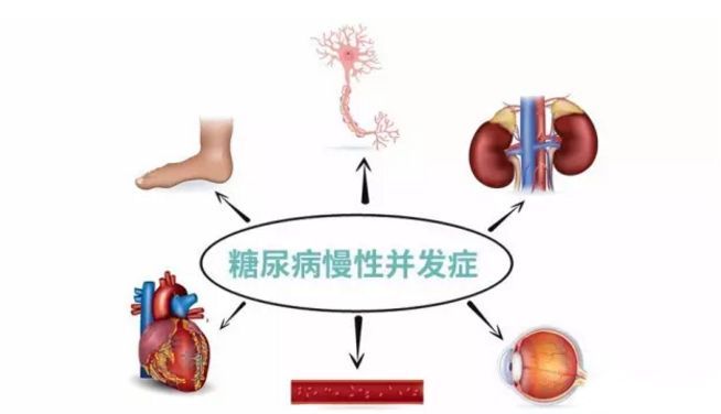 血糖波動大，并發(fā)癥來得快，糖友要多補硒